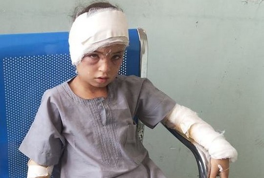 נור אל-אנקר, בת 9. ביתה נפגע מהפגזת הארטילריה הישראלית הכבדה על שג'עיה ביום ראשון בלילה. אמה, סבתה ושני אחיה הצעירים נפצעו קשה. (צילום: עאוני פרחאת)