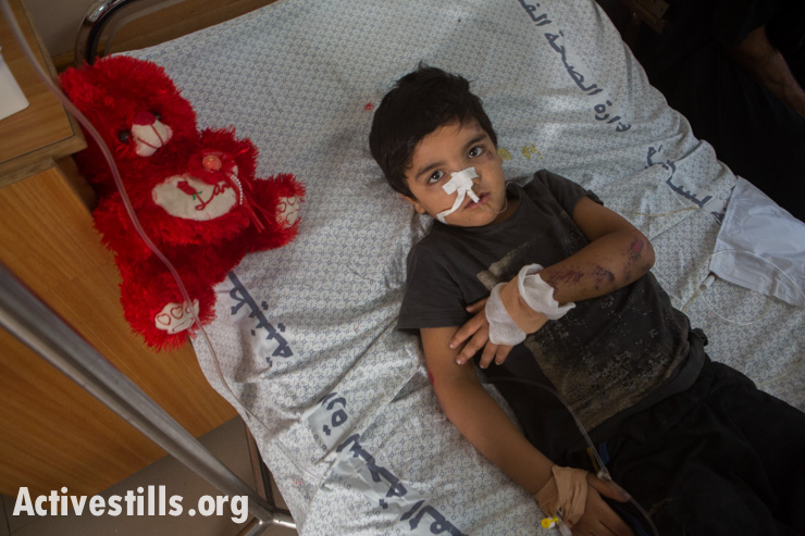 ילד בן 4 שוכב בבית החולים שיפא בעזה, לאחר שנפצע בתקיפה ישראלית. עוד ארבעה מבני משפחתו נפצעו בתקיפה. 14 ביולי 2014 (אקטיבסטילס)