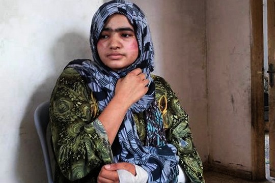 נעמה אבו ג'ראד, בת 21, שנפצעה במהלך התקיפה (עאוני פרחאת)