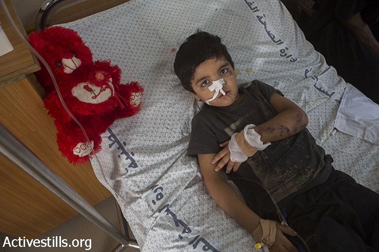 חמדה עבדון, בן 4, שוכב בבית החולים שיפא לאחר שנפצע באחת ההפצצות. יחד איתו נפצעו ארבעה מבני משפחתו. 14 ביולי, 2014. (אקטיבסטילס)