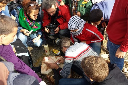 מפגין שנפגע מירי בקרסולו בנבי סלח. צילום: אבי לבכרמן