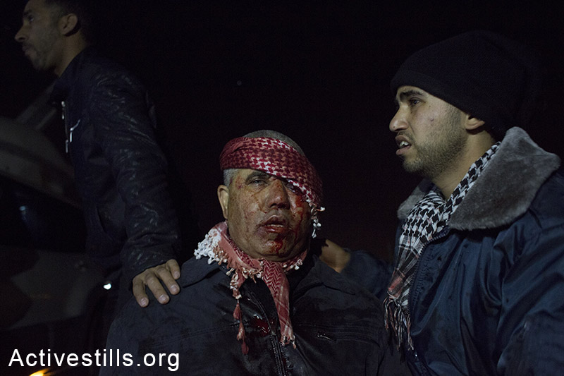 משתתף בהלווית סמי אל-ג׳עאר נעזר בקרוב לאחר שנורה בכדור גומי בעינו, רהט, ישראל, 18 לינואר, 2015. רכב משטרה שנכנס לתוך מסע ההלוויה של אל-ג׳אר, נקלע לעימות והחל לירות כמויות גדולות של תחמושת חיה וגז מדמיע. במהלך האירוע נהרג אדם נוסף, סמי אל זיאדנה, בן 42, ונפצעו מעל 40. אקטיבסטילס