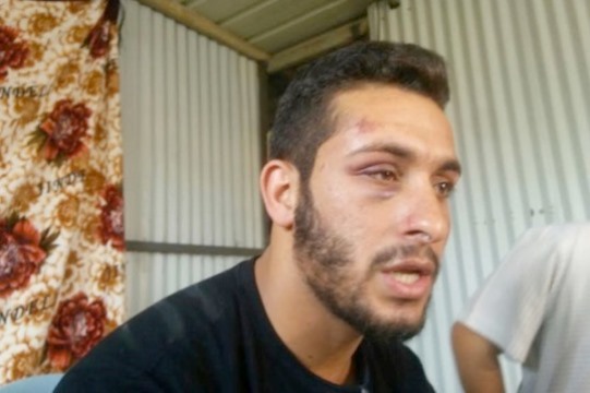 מייסם אבו אל-קיעאן לאחר שהוכה על ידי שוטרים במרכז תל אביב (צילום: הפורום לדו קיום בנגב)