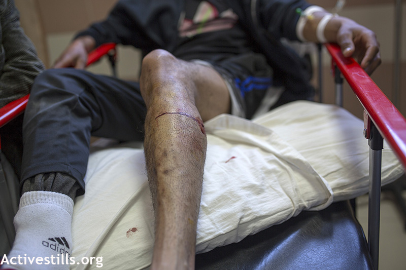 רגלו של מפגין נוסף שנורה על ידי הצבא, בחדר האשפוז בבית החולים ברמאללה, הגדה המערבית, אפריל 3, 2015. אן פאק / אקטיבסטילס