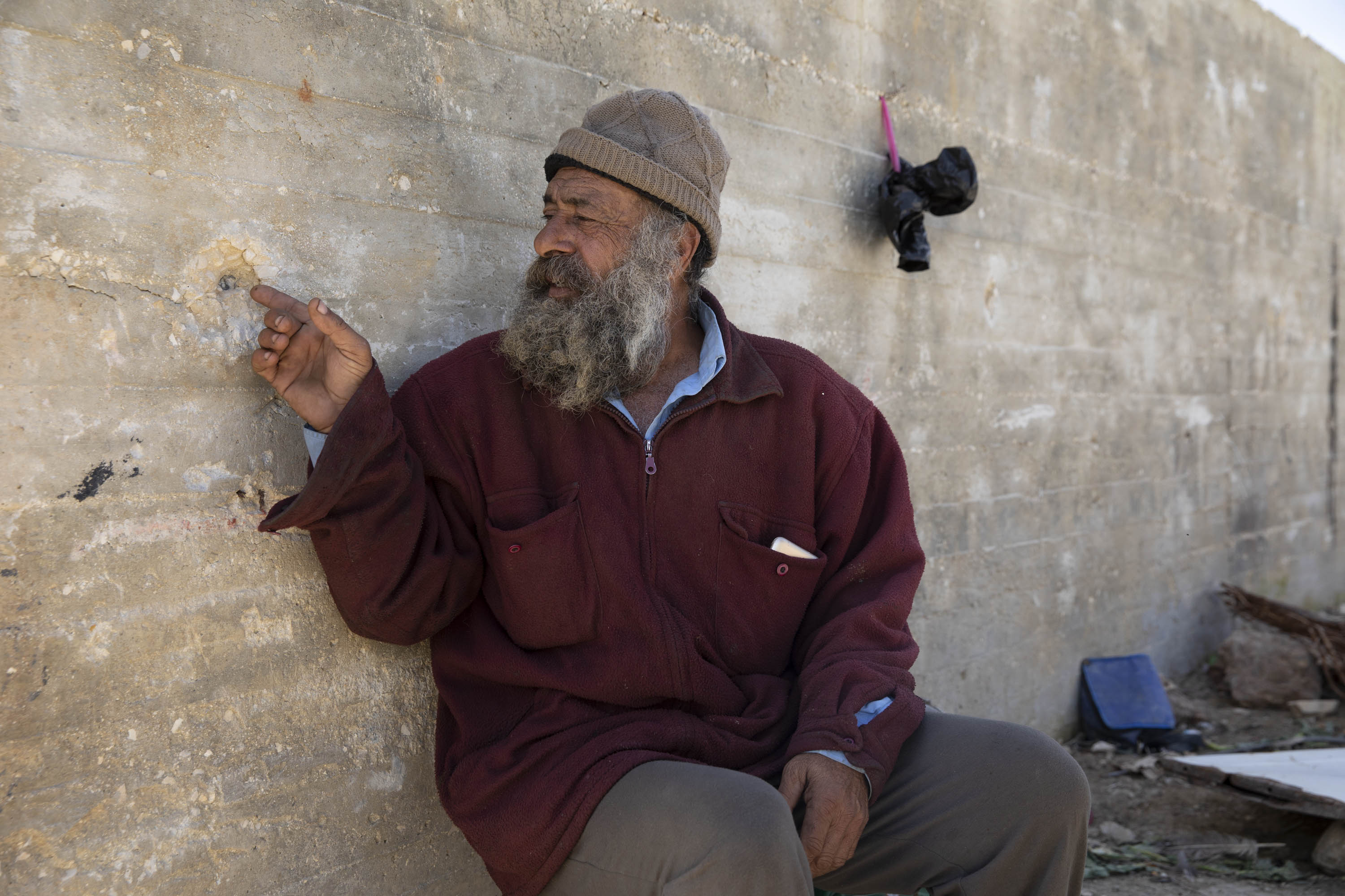 ״הקליע פספס את ראשי בכמה סנטימטרים״. מוניר סולימאן מהכפר עוריף (אורן זיו/ אקטיבסטילס)