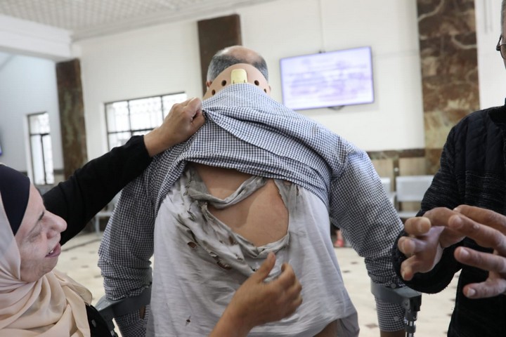 סימני החבלה על גבו של אבו חומוס (צילום: אורן זיו)