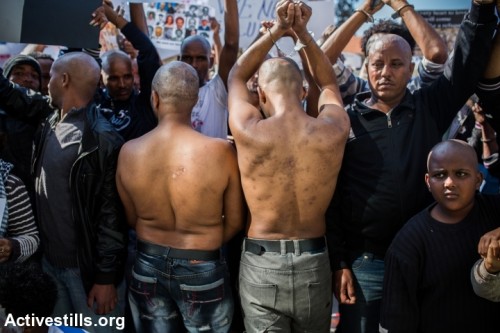 מבקשי מקלט בישראל מציגים צלקות שנגרמו להם על ידי מבריחים במחנות העינויים בסיני (יותם רונן/אקטיבסטילס)