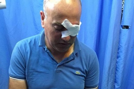 נידאל שתייה, שנורה על ידי חיילים ונפצע בעינו, בבית החולים (צילום: אחמד טלעת חסן)