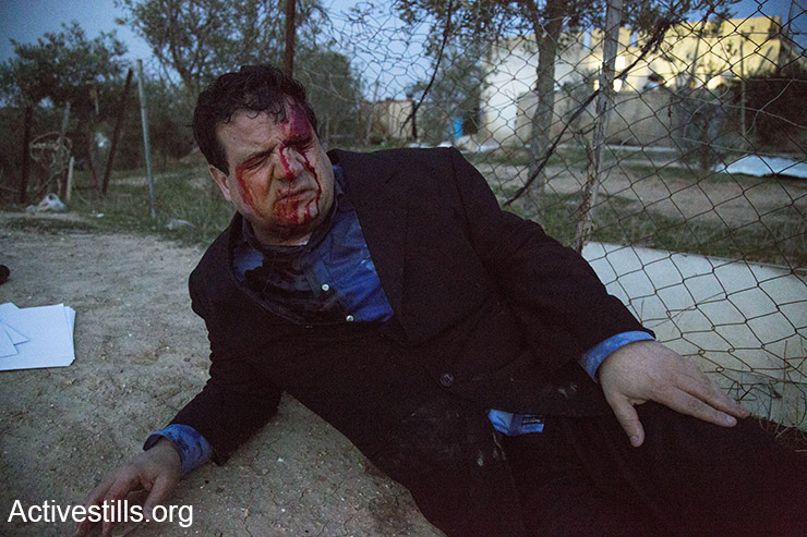 איימן עודה, פצוע מירי המשטרה באום אל חיראן (קרן מנור/אקטיבסטילס)