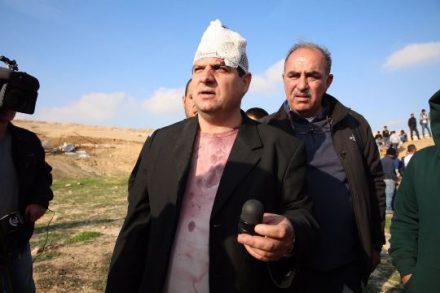 יו"ר הרשימה המשותפת ח"כ עודה מחזיק את אחד משני הכדורים שפצעו אותו. (צילום: דוברות הרשימה המשותפת)