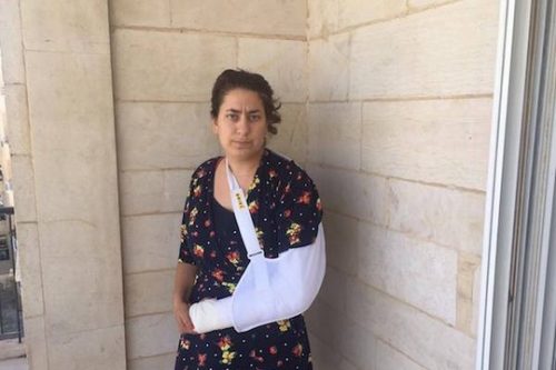 שרה ברמר שליי ביד חבושה לפני הניתוח (צילום: אליענה פישמן)
