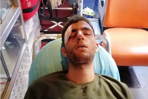 פצוע מזריקות אבנים, עסירה אלקיבלייה (צילום: הסהר האדום)