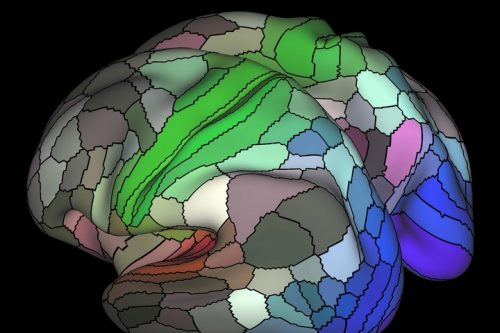 המחקר בדק איזה אזורים במוח "נדלקו" כאשר הוצג לנחקרים ישראלים וערבים הסבל של הצד השני. (צילום: NIH CC BY-NC 2.0)