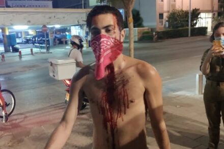 המפגינים הם שהבריחו את התוקפים, לא המשטרה. שי סקלר אחרי שהותקף בהפגנה בתל אביב (צילום: בן נצר, גל"צ)