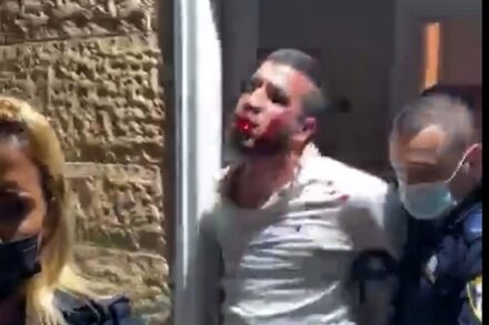 ההסתה של תקופת נתניהו גרמה לנו לשסף וירטואלית זה את גרונו של זה. צעיר שהוכה על ידי שוטרים בגבעת זאב (צילום מסך, שימוש לפי חוק לזכויות יוצרים)