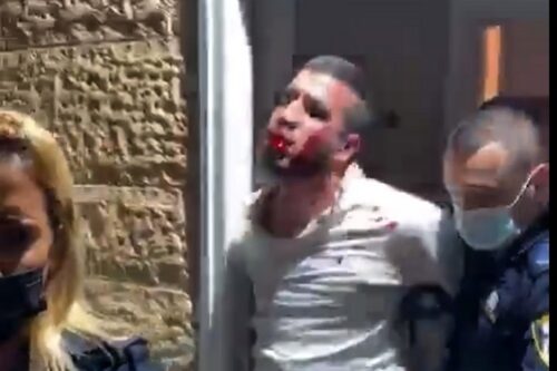 ההסתה של תקופת נתניהו גרמה לנו לשסף וירטואלית זה את גרונו של זה. צעיר שהוכה על ידי שוטרים בגבעת זאב (צילום מסך, שימוש לפי חוק לזכויות יוצרים)