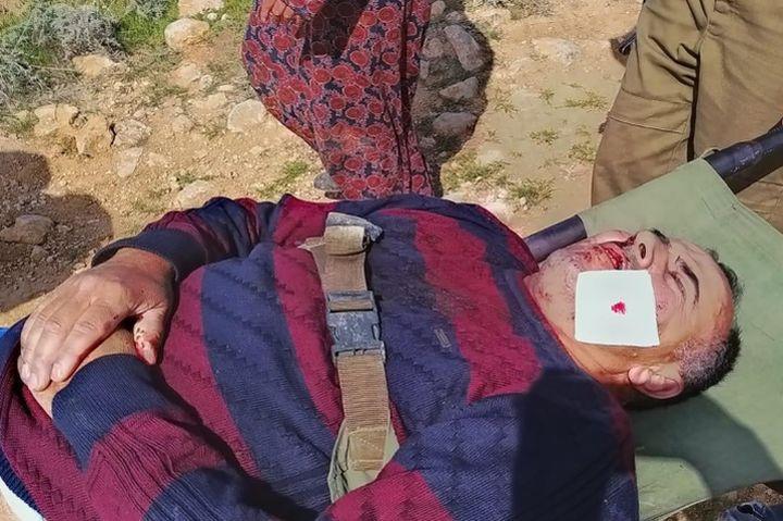 סעיד עליאן מובל לטיפול רפואי אחרי שהותקף בידי מתנחלים ממאחז מצפה יאיר, 13.3.2021 (צילום: גיא בוטביה)
