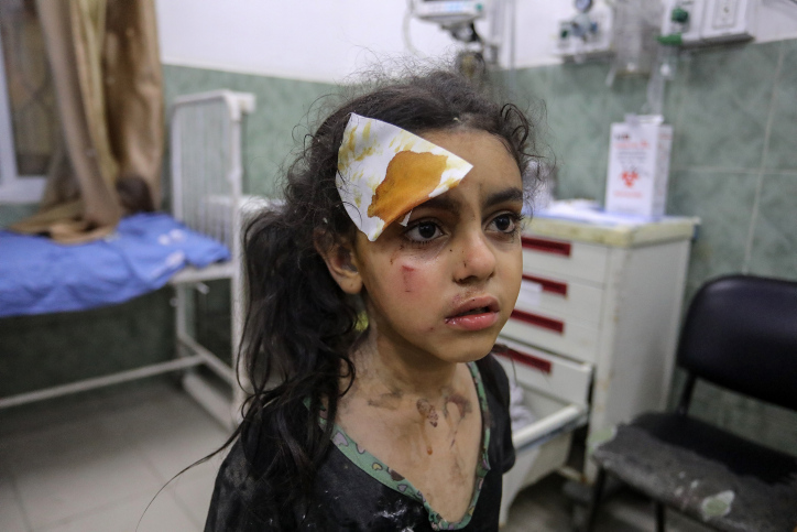 "מפחדים לצאת החוצה". ילדה פלסטינית מקבלת טיפול בדרום רצועת עזה (צילום: עבד רחים ח'טיב / פלאש 90)