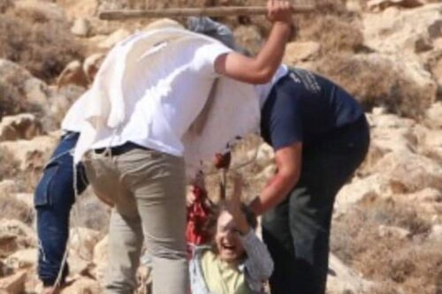 "אולי היא חשבה שלא יתקפו אותה כי היא מבוגרת". מתנחלים תוקפים את הגר גפן במהלך מסיק בכפר כיסאן