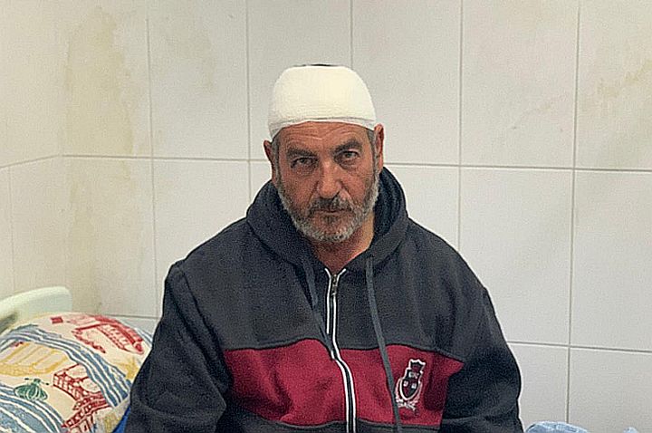 המתנחלים אמרו לו: לא רוצים לראות אותך פה. עלי אל-משני בבית החולים בחברון (צילום: באסל אל-עדרה)
