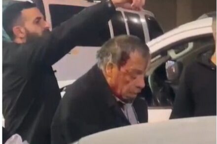 "זה היה מצב לא נורמלי, כל המשפחה פצועה". עומר חליפה לאחר שהוא ובני משפחתו הותקפו על ידי מתנחלים (הצילום באדיבות תושבי חווארה)