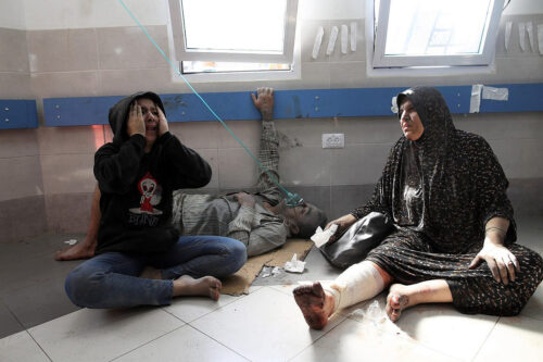 פצועים בבית החולים שיפא בעיר עזה, ב-18 באוקטובר 2023 (צילום: מוחמד זענון / אקטיבסטילס)