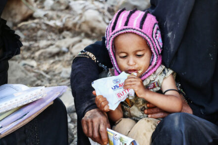 סיוע של USAID לילדים בתימן, ב-2017 (צילום: USAID / פליקר, CC BY-NC 2.0)